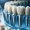 pose d'implants dentaires
